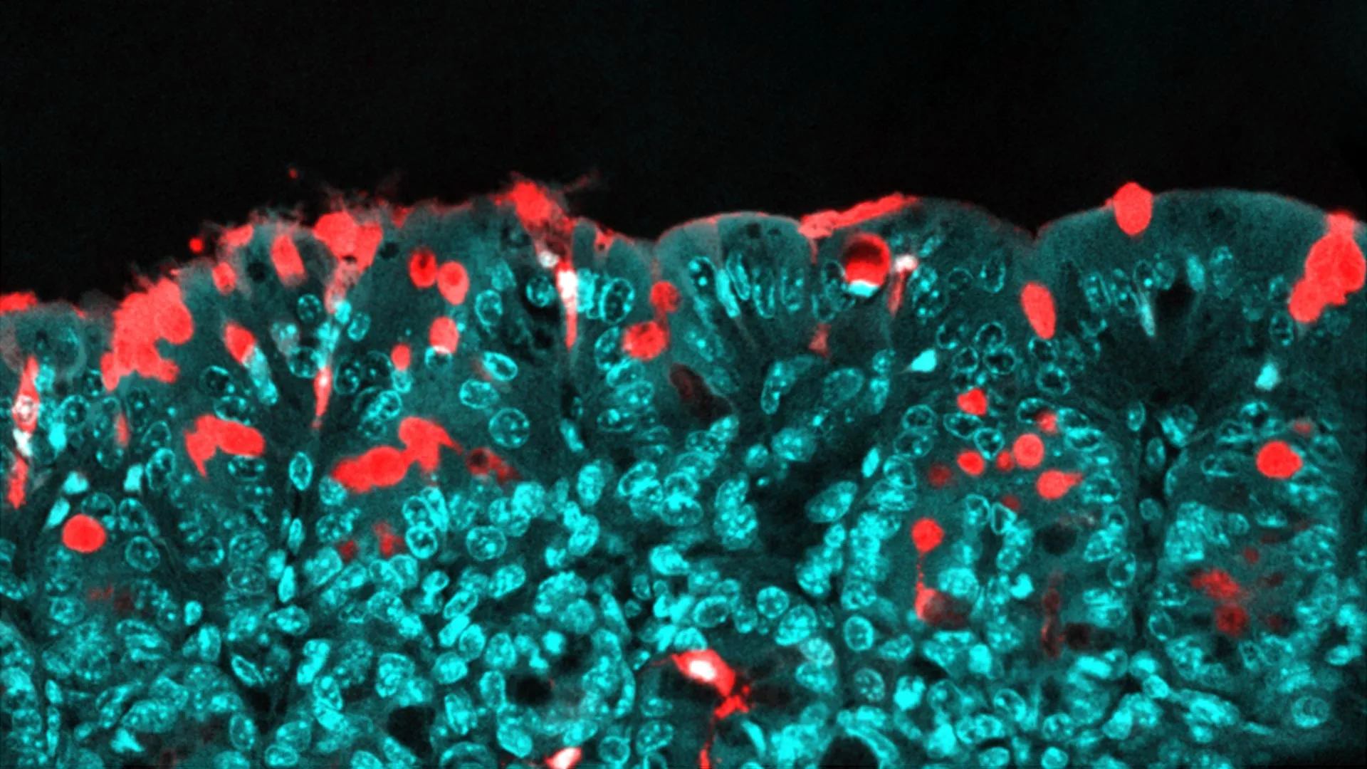 Dietary Emulsifiers: Unveiling Transgenerational Effects on Gut Microbiota and Lifelong Chronic Disease Risk