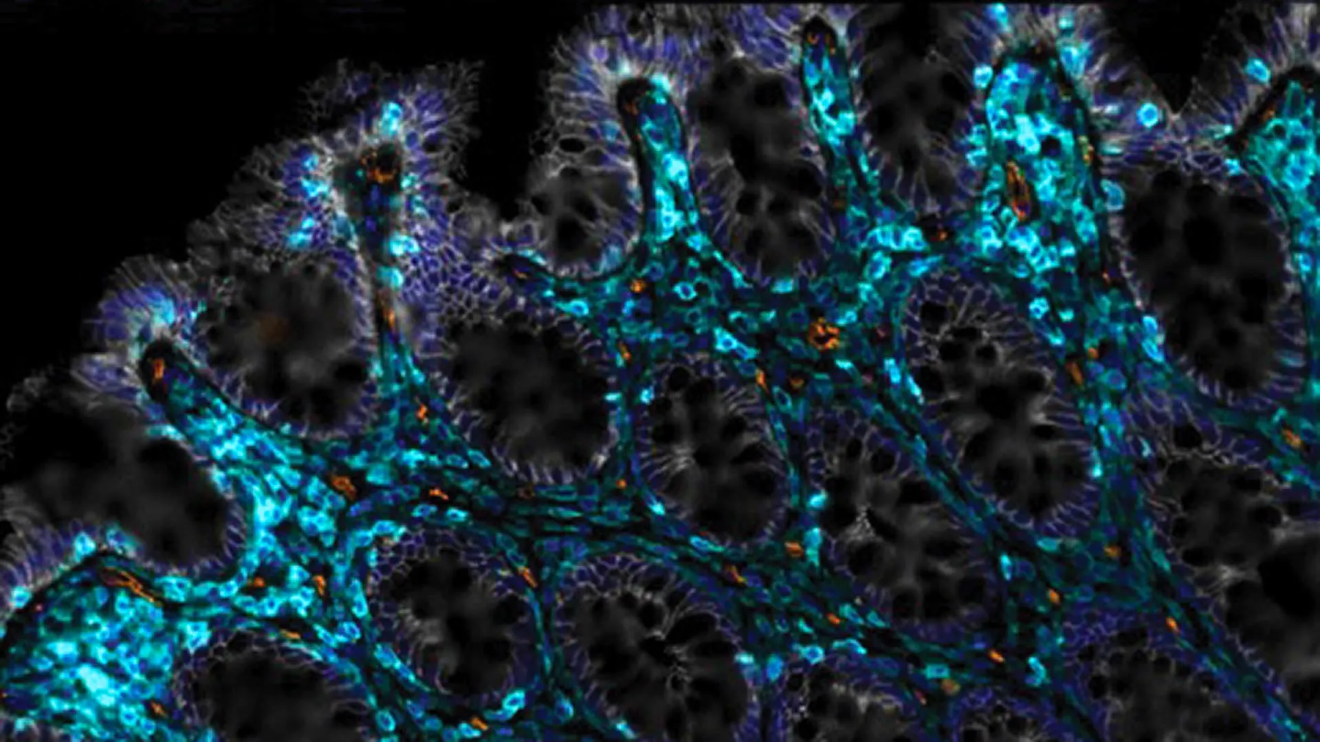 Revolutionizing Gut Health: Pioneering Immunotherapy Harnesses Cellular Mechanisms to Restore Intestinal Integrity in Aging and Damaged Tissues