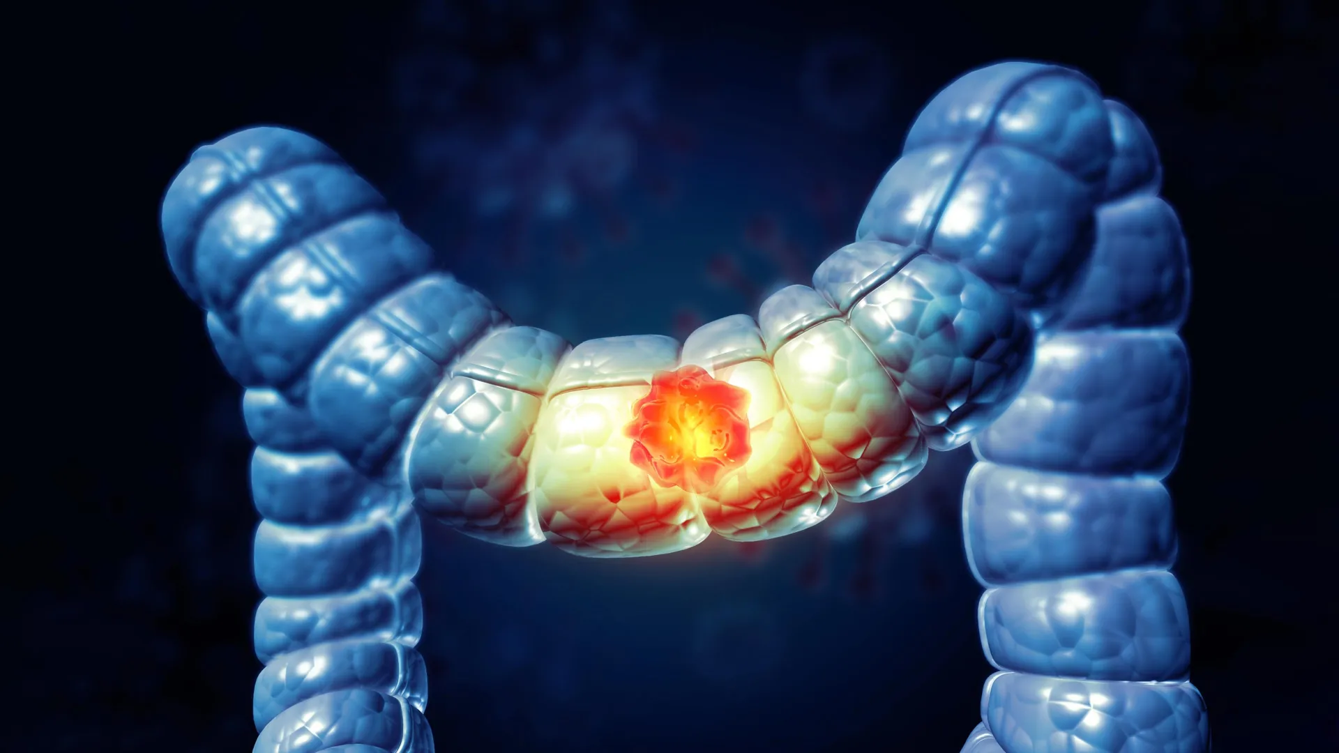 Decoding the Immune Enigma: Unmasking the Dual Role of Regulatory T Cells in Colorectal Cancer