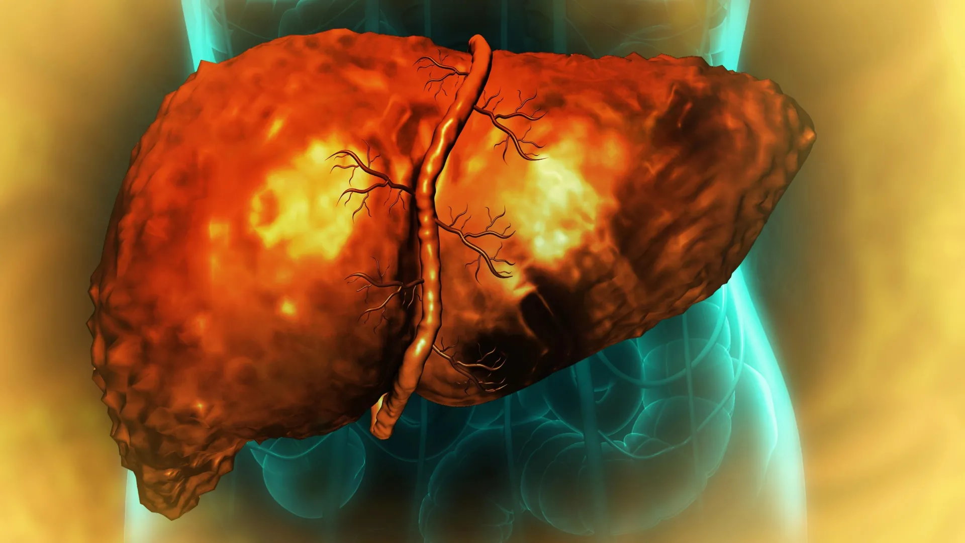 Unraveling the Persistent Enigma of Liver Regeneration Failure Post-Alcohol Cessation