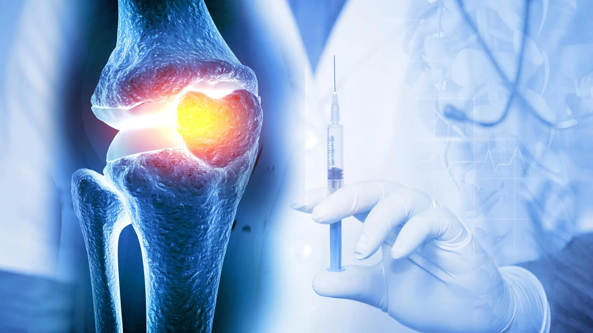 Innovative Injectable Depot System Promises Extended Therapeutic Efficacy for Joint Degenerative Diseases